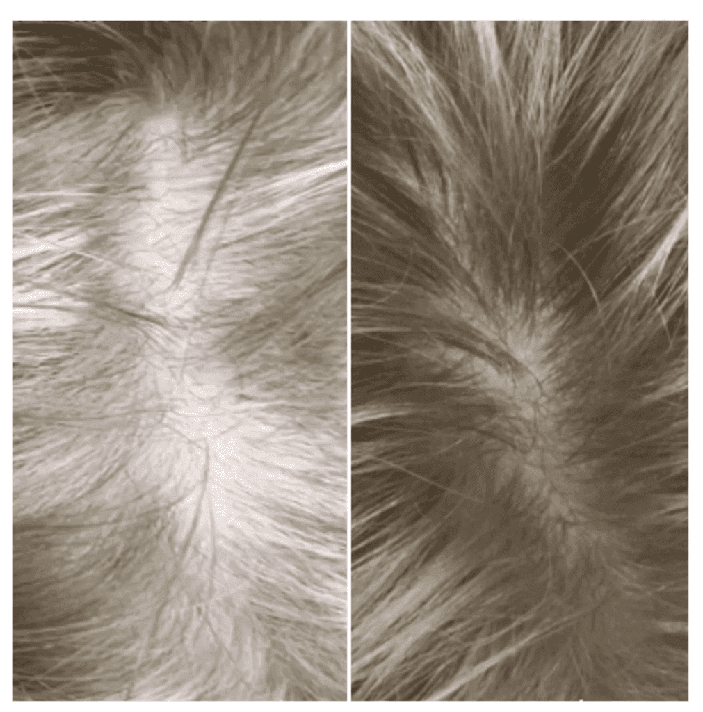 Visit The Headroom for Thinning Hair Solutions
